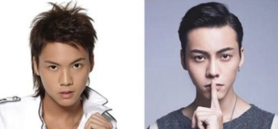 为什么女人整形花样多，男人整形却只有两个方向？