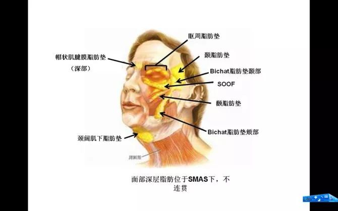 而面中部肌肤层是融合,连续的层次,皮下方存在一层皮肤脂肪层,主要有