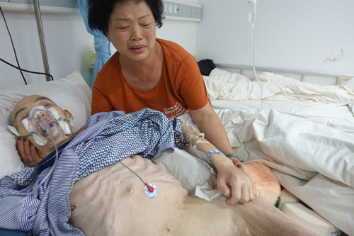 武汉人民医院危重病人张习辉进"中风脑卒中"死亡线上挣扎