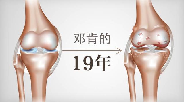 NBA球星邓肯的运动康复之路