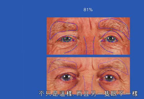 毫无血缘关系却长得一模一样，世界上真的有另一个你