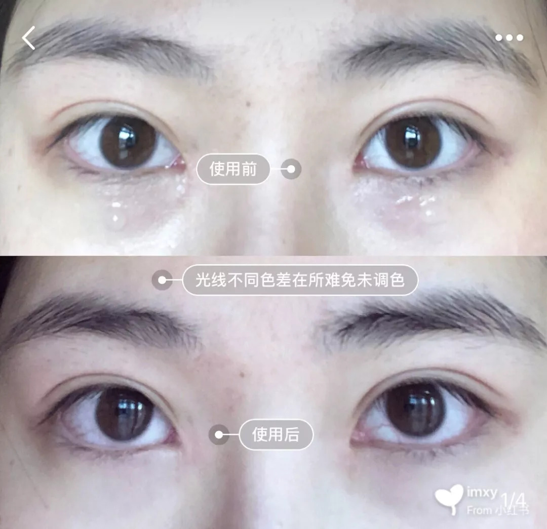比同龄人老怎么办？