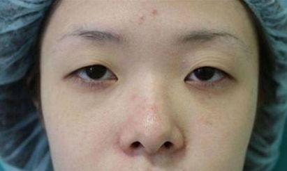 林允的大小眼已经严重到变成“肌无力”了···