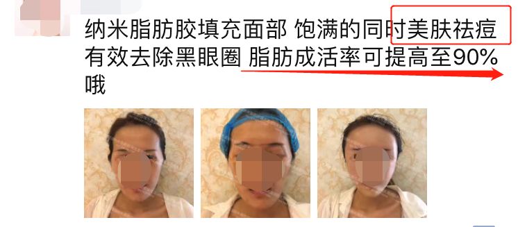 回春没多久的杨紫，咋又肿成这样了？