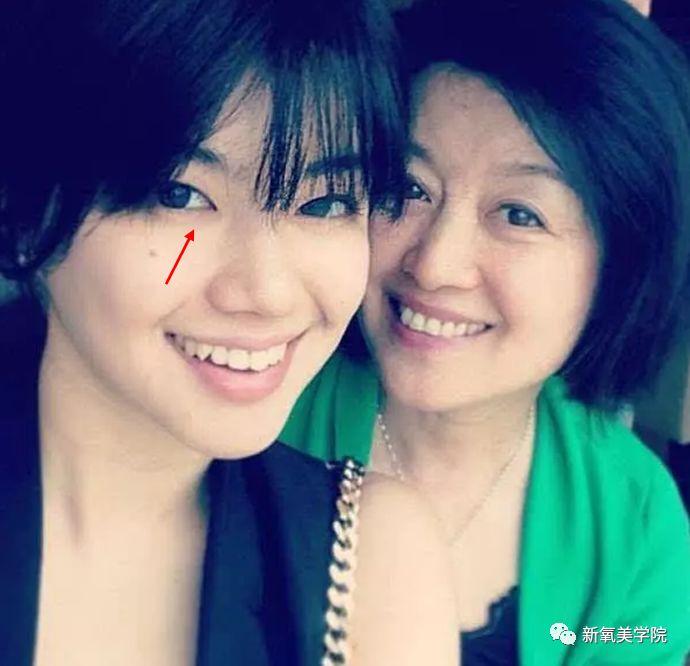 陈坤签的新人这个鼻子假体有点夸张哦！