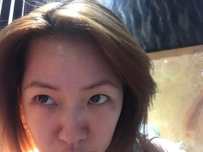 小s自曝脸上的肉毒杆菌和玻尿酸快消失了，她为此感到开心