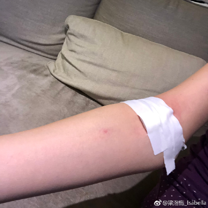 梁洛施生病暴瘦吓坏网友，大臂比小臂还要细！