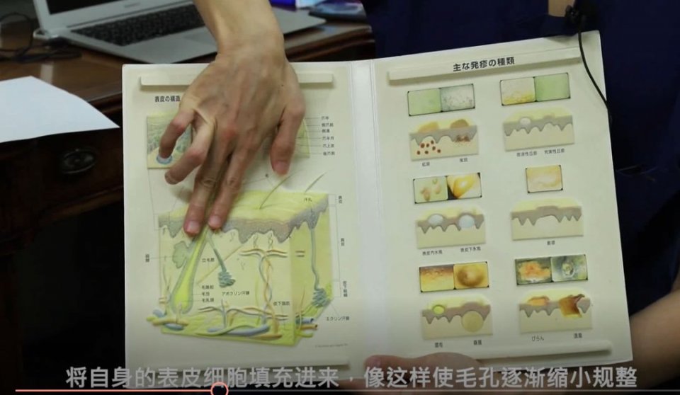 迷死氧日本亲身体验2，我用脖子上的皮给自己缝了毛孔