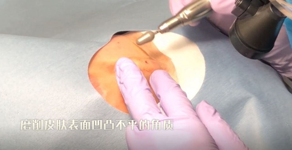 迷死氧日本亲身体验2，我用脖子上的皮给自己缝了毛孔