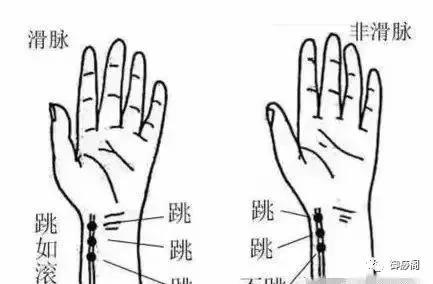 中医“把脉”的原理是什么?小学生都看懂了!