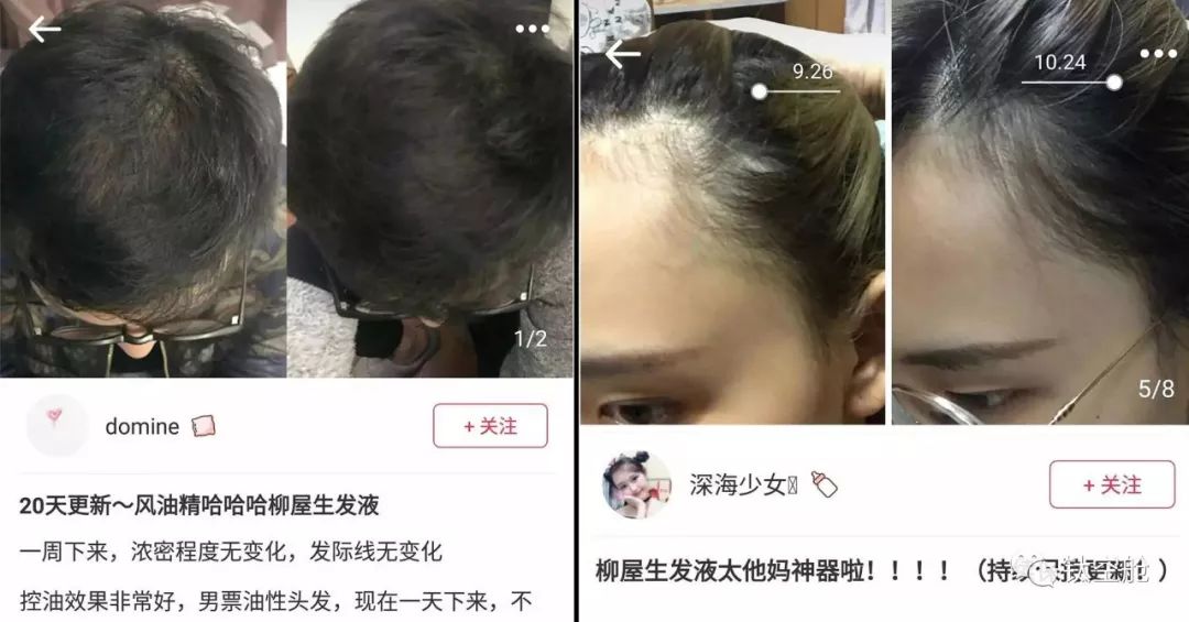 你连头发都没有，还敢“龙抬头”？两款“生发利器”可以拯救发际线 | 钛空舱