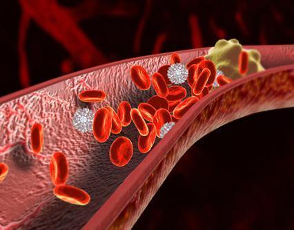 血管堵了是血管仍是里边的血有了问题？与每天饮食的联系有多大？