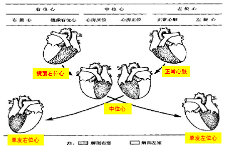 心脏轴线是自心尖至心底的垂直线.