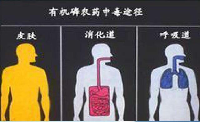 职业病磷及其化合物中毒