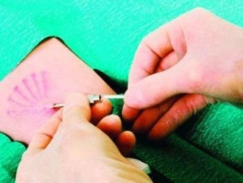 不吃药、不上环、不用套，用一根线避孕成功率就高达99.95%？