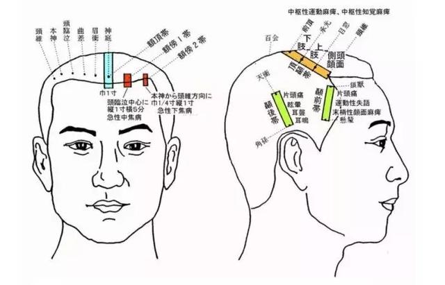 看懂这张图,穴位不用找(人体全息图)
