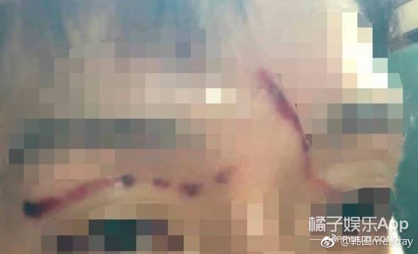 为了这种渣男自杀，真的不值得！