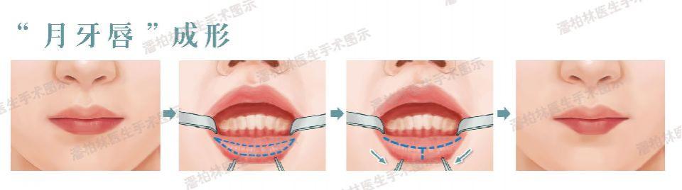 大家心目中的文艺女神虽然是内牛五方脸，但下唇暗藏着小心机