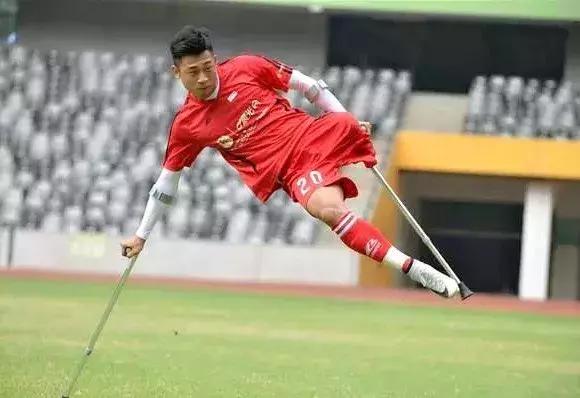 经历三次截肢手术也不放弃足球梦,“独腿球王”何忆义的励志人生