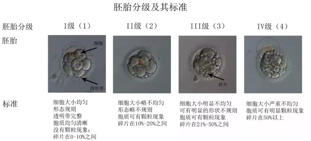 胚胎碎片类型及其标准 囊胚评分 按照囊胚腔的大小和是否孵出将囊胚
