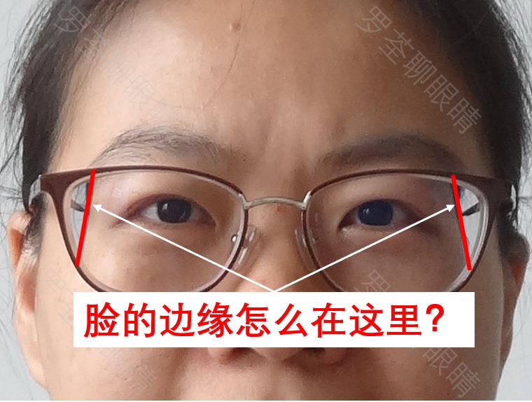 戴近視眼鏡後，真的會「變醜」？眼科醫生坐不住了 健康 第3張