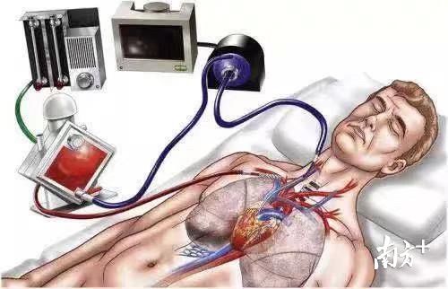 放假报复性熬夜打游戏,20岁女大学生把自己弄进了icu