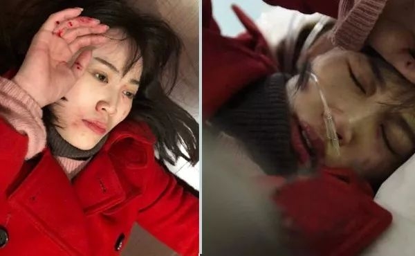 马蓉伤照被指摆拍，后被友人背着跑出院，网友：那我们来P图吧！