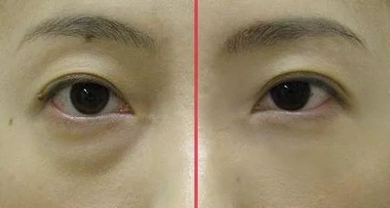 被于正合影坑成网红脸的吴谨言，当天的脸视觉中国都挑不出错