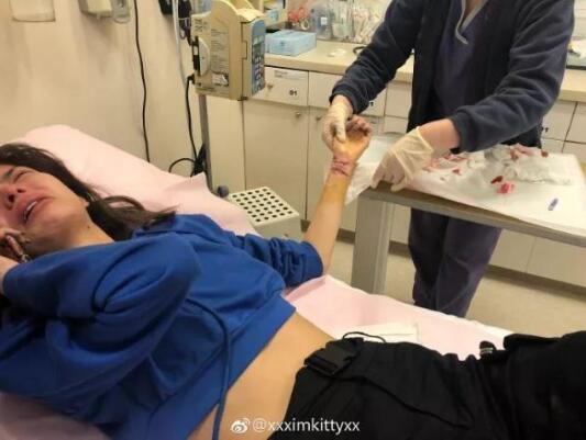 Naomi不堪舆论压力割腕，因丑闻曝光，竟跟陈冠希有过一腿？