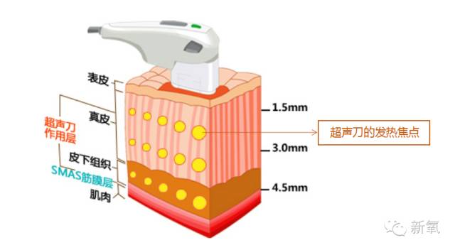 可怕！当红女明星脸上集体出现了这个东西！
