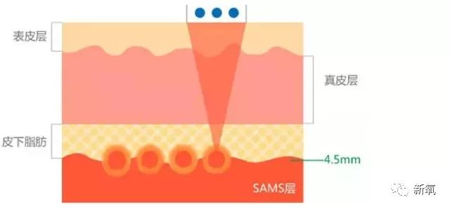 可怕！当红女明星脸上集体出现了这个东西！
