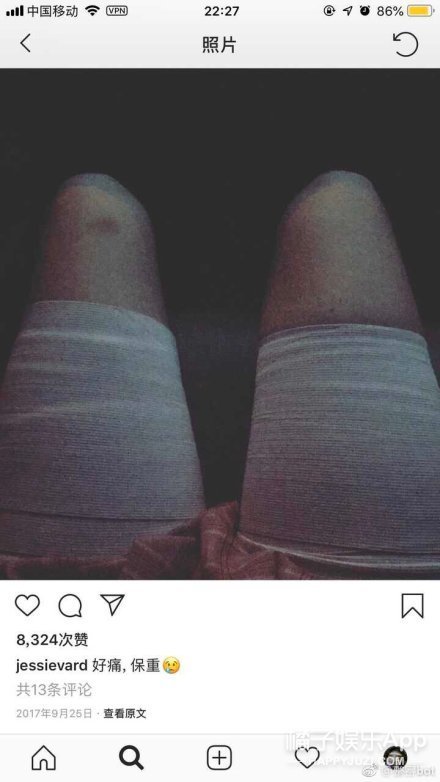 晚报|金莎为翻唱歌曲找寻著作人 爱尔兰名模整容过程曝光