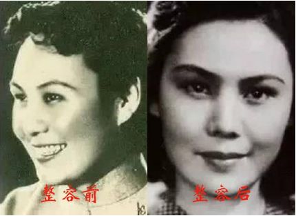 她们的18岁成人礼：一批新鼻子