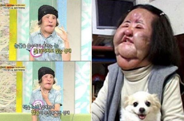 韩国美女明星整容上瘾，导致脸部变形毁容，睡觉都无法闭上眼！