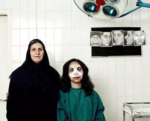 12岁整鼻到20岁还没拆绷带，只是为了炫富？