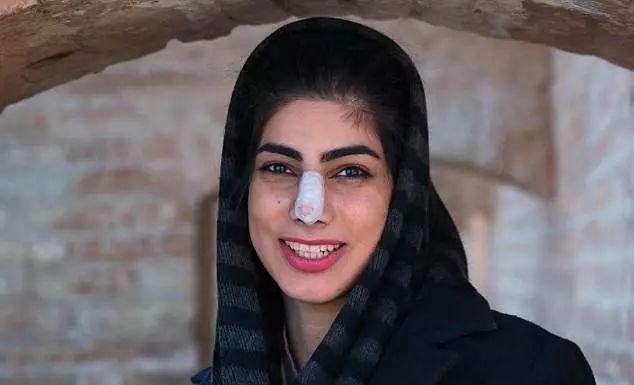 12岁整鼻到20岁还没拆绷带，只是为了炫富？