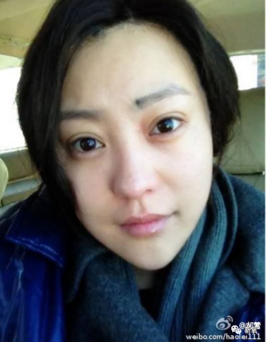 瞎整派掌门人杨紫终于翻身了，这个部位整得一雪前耻！
