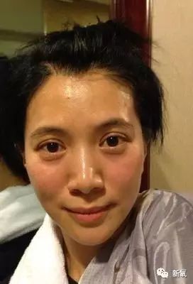 瞎整派掌门人杨紫终于翻身了，这个部位整得一雪前耻！