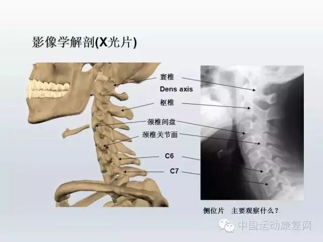 因为地球引力的缘故,当颈部弯曲60 度时,颈椎承受的压力会达45斤重