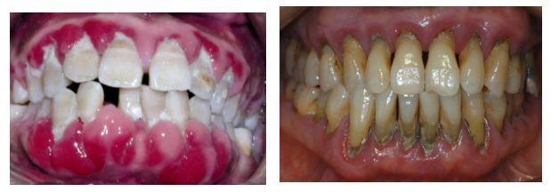被男主角吐槽演吻戏不刷牙,口臭到拍不下去··· 白瞎了这个颜值惹!