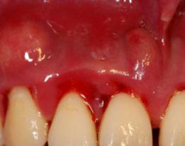 被男主角吐槽演吻戏不刷牙,口臭到拍不下去··· 白瞎了这个颜值惹!