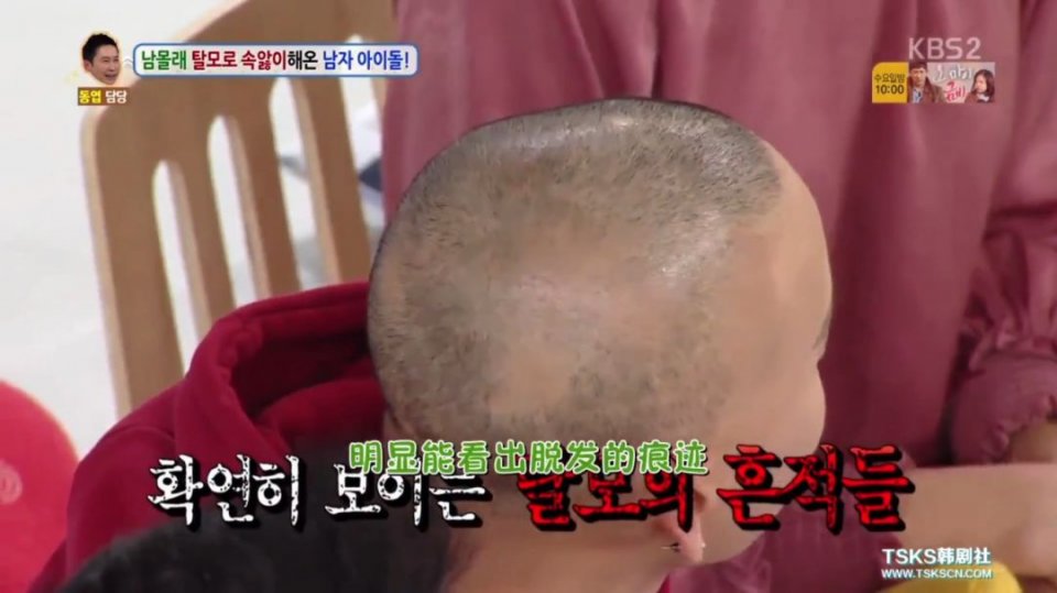 性感爱豆，在线秃头