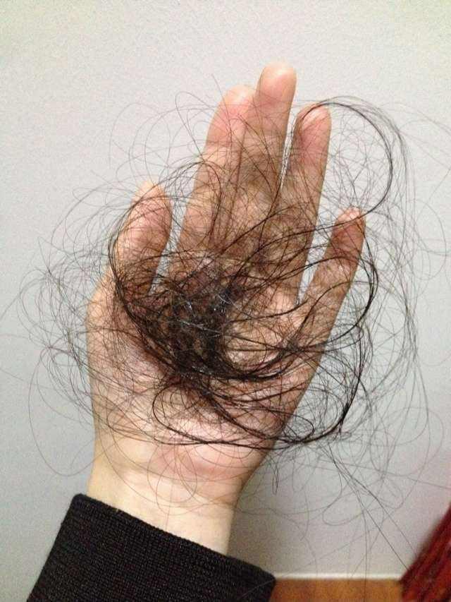 脱发除了雄性激素的原因,也有可能跟你的发质有关系!