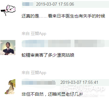 她这下巴是不是整失败了？