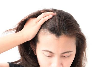 如何判断你的发际线是否后移？发际线后移怎么恢复？