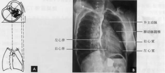 (三)左前斜位