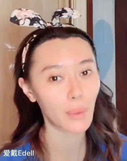 海归学历造假、被王思聪怼下巴“与时俱长”的女星，这张新脸吓哭网友···