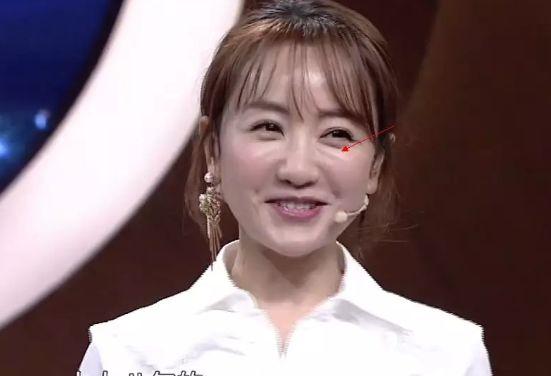 林允儿的神颜也崩了！脸歪+填充成气球，这两道沟又是什么鬼？