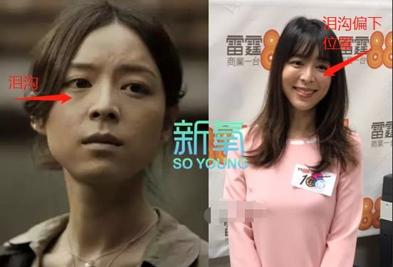 林允儿的神颜也崩了！脸歪+填充成气球，这两道沟又是什么鬼？