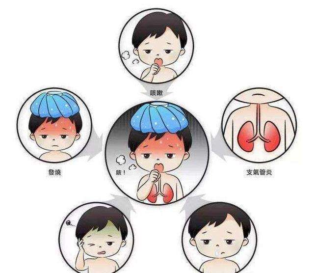 鼻窦炎的症状表现